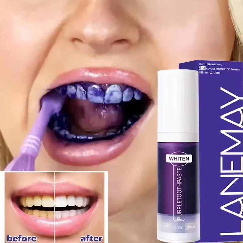 V34 Paarse Tanden Whitening Ta - Purple Toning Shampoo recensie en prijs